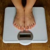 Doctors are calling for “'bld measures' to tackle the problem of childhood obesity