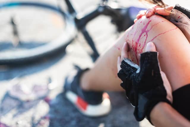 Ten cyclists were injured last year in Chesterfield - four of them seriously. Photo: Shutterstock.