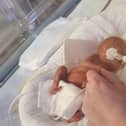 Evie Hope Humphries was born extremely prematurely at 23 weeks and six days on February 14, weighing 1 pound 4 oz.