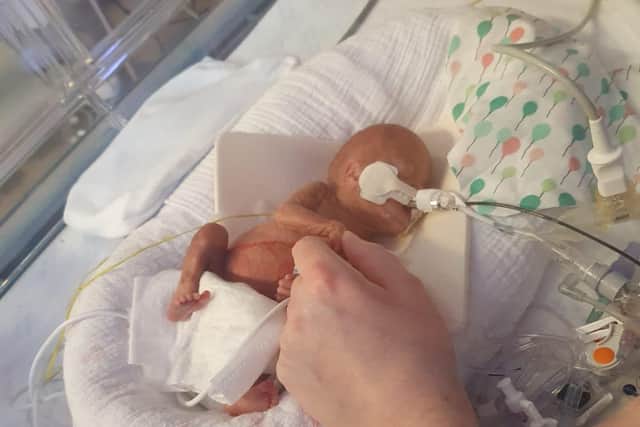 Evie Hope Humphries was born extremely prematurely at 23 weeks and six days on February 14, weighing 1 pound 4 oz.