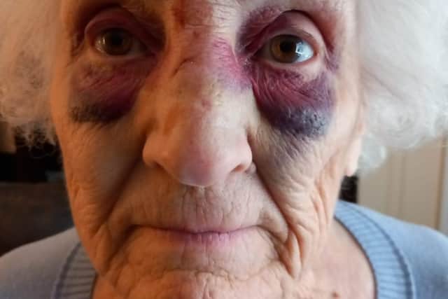 Carrie said her mum’s injuries could have been even worse.