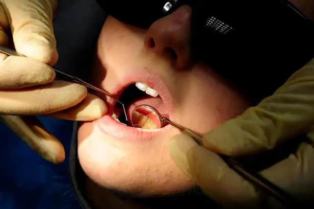 The British Dental Association said the data "understates the level of demand, given huge backlogs.