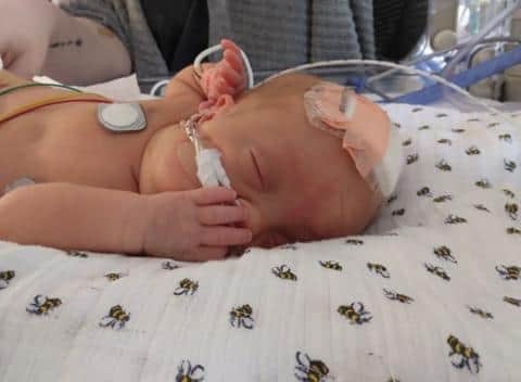 Hunter-Lee Hamlin was born prematurely at 24 weeks