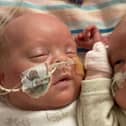 Little Harley and Harry Crane were conceived via IVF and were born at 22 weeks and five days.