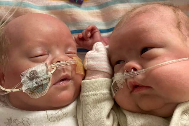 Little Harley and Harry Crane were conceived via IVF and were born at 22 weeks and five days.