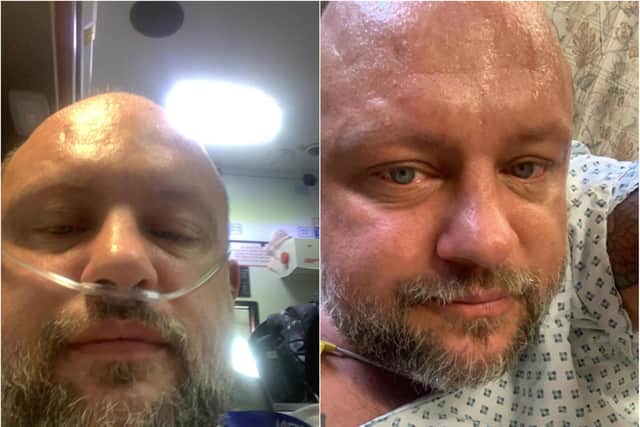 Gary Topley pictured right, in the ambulance being transferred to Sheffield after his heart attack and left, when he began sweating profusely