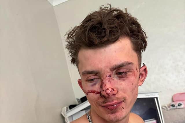 Joshua Marven says he was headbutted while standing at the bar and chatting to a friend at Chesterfield’s Vibe Bar