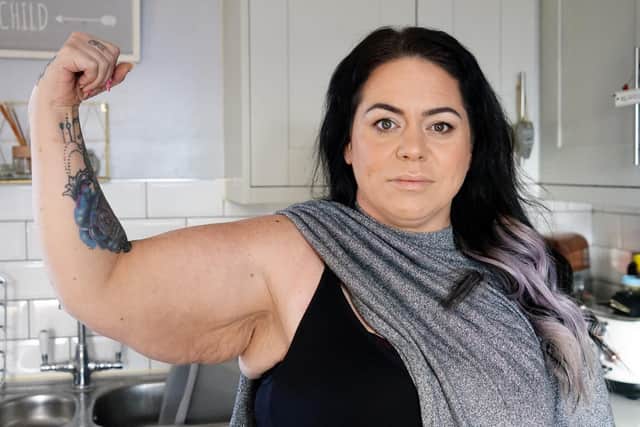 Tara Brown is aiming to raise enough money to have loose skin removed from her arms, tummy and thighs after her amazing weight loss.