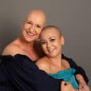 Pictured left Julie Powell (55), from Warsop, near Mansfield, and right Bianca Markham (31) from Chesterfield who became friends during their cancer treatments