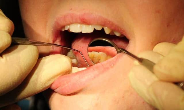 NHS Digital data reveals 168,000 dental treatments were given to NHS patients in Derbyshire between June 2020 and March this year – a 72% drop from 601,000 in the same period the previous year.