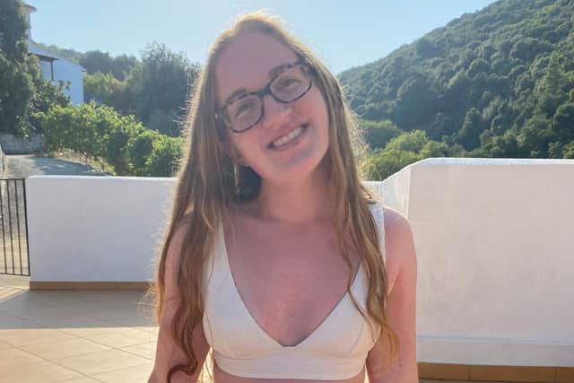 Allie Wildgoose, 19, from Bradwell, has a scar on her stomach from surgery for a serious bowel infection, which she contracted following her premature birth.