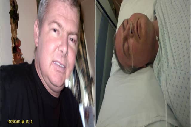 Simon pictured left, during his dialysis treatment and depression, and right, in hospital