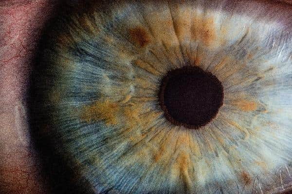 Choosing the right cataract lens type is crucial for achieving the best possible outcome after cataract surgery