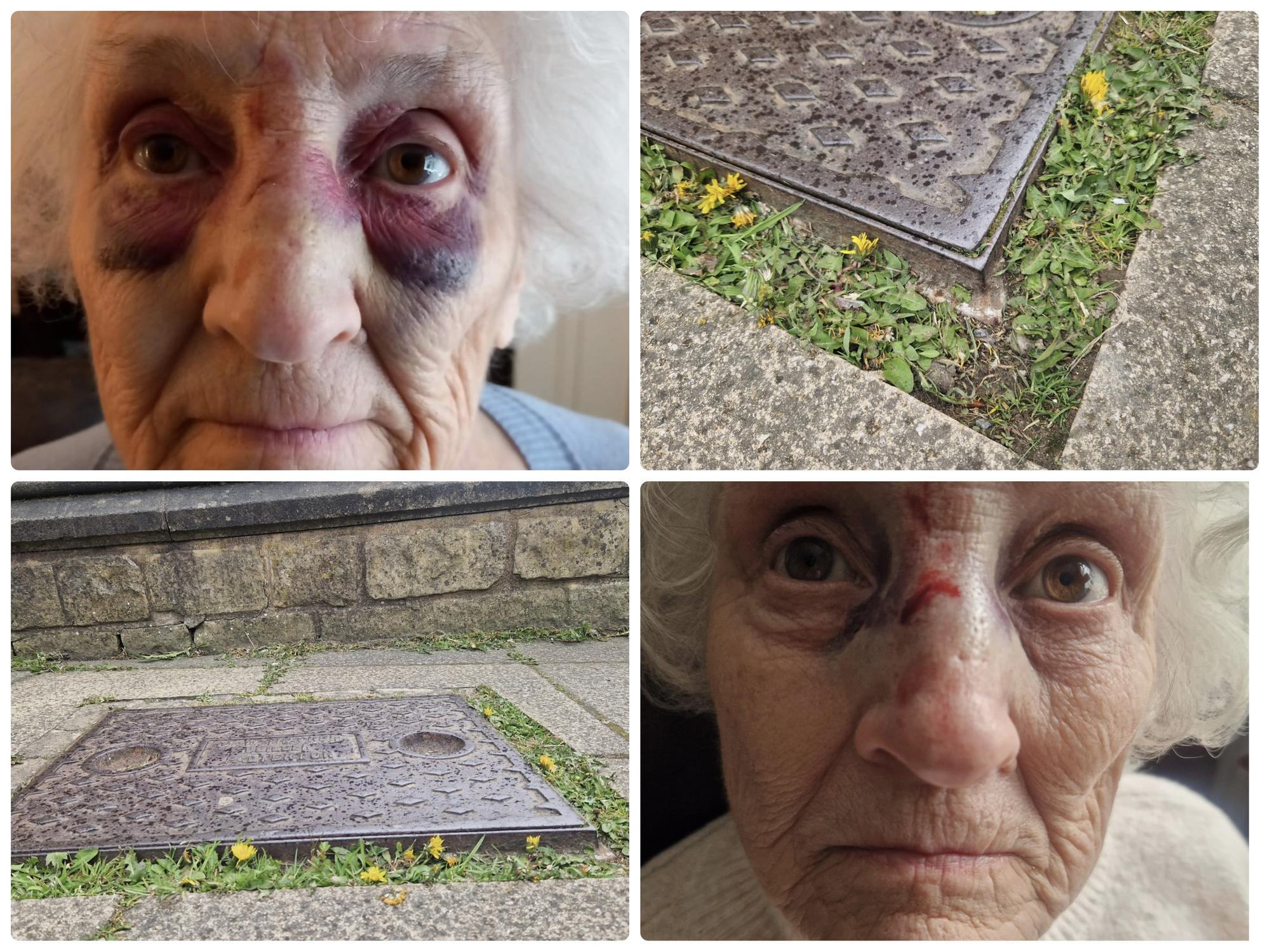 Derbyshire woman slams council after fall left her elderly mum with broken nose and black eyes - Vimarsana News