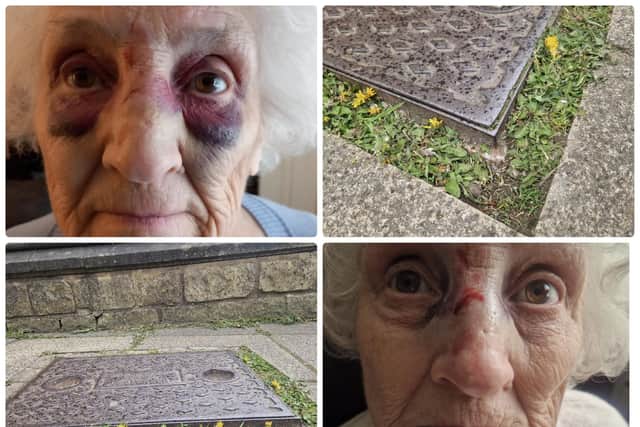 Mary was left with a broken nose after the fall.