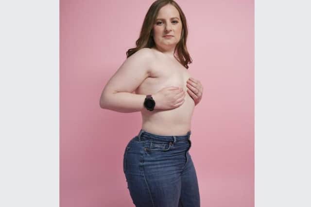 Cassie D'Apice has posed for topless photos – five years after she was diagnosed with breast cancer.