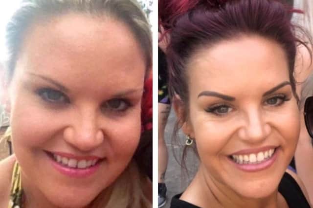 Kate Richmond's before and after photos from her incredible weight loss journey.