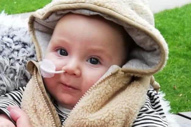 Marley has a rare genetic condition and his family need to raise £25,000 to receive treatment in America.