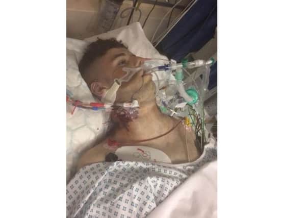 The family have shared this heartbreaking image of James on life support in the hope it will make others think twice before taking drugs.