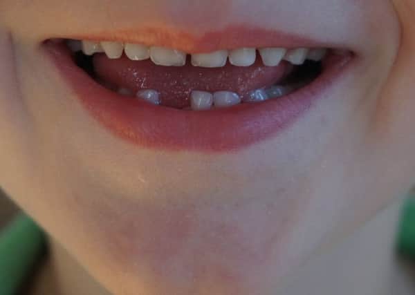 Child's teeth. Photo by Pixabay.