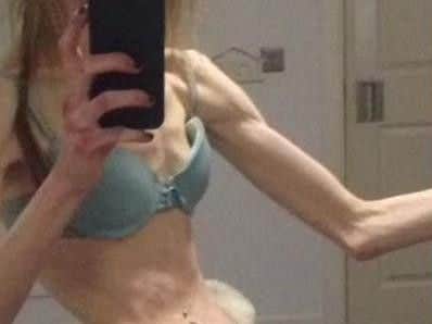 Annie has shared her story to help others who might be struggling.