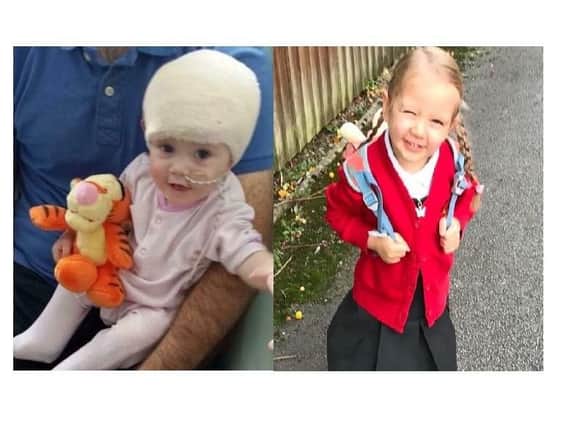 Lucy as a baby after being diagnosed with a brain tumour, and Lucy aged five.