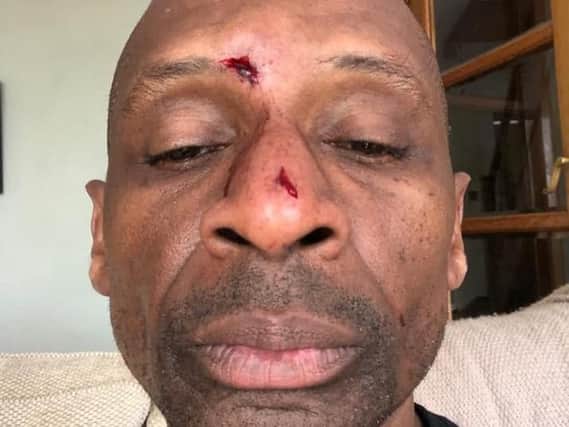 Andy Abraham suffered head injuries during a fall at home