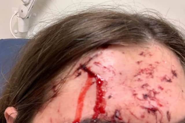 Rhiannon has bravely shared photos of her injuries in the hopes someone with information will come forward.