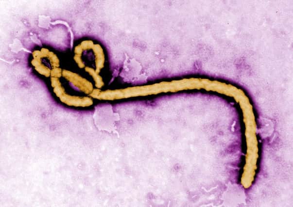The Ebola virus.