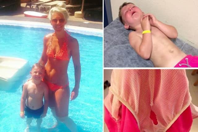 Laura Collins and her son jack were on holiday in Lanzarote when he got his penis caught in the netting of his swimming shorts