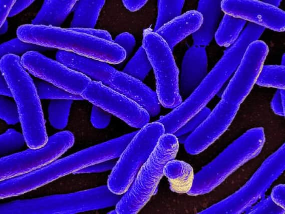 Escherichia coli is an intestinal bacteria normally found in the systems of humans and animals - infections can cause symptoms of diarrhea, abdominal pain, and fever.
