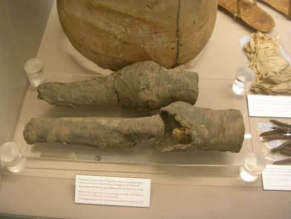 Thease are believed to be the mummified legs of Queen Nefertari. Photo by Professor Joann Fletcher