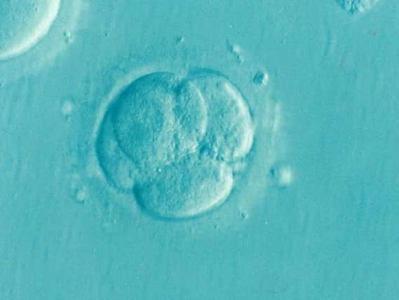 IVF is one of several techniques available to helppeople with fertility problems have a baby.