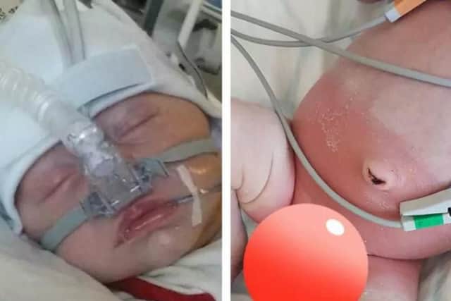 Mr Bartliff claims ASDA own brand nappies caused his newborn son to require oxygen and irritated his skin. (Photos: Jordan Bartliff/Facebook)