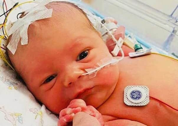 Baby Cayden received emergency care to prevent any brain damage after complications in his birth last year.
